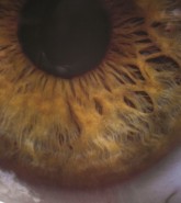 BSc (Hons) Vision Science